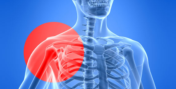 Shoulder pain Shoulder Pain - rotator cuff injury