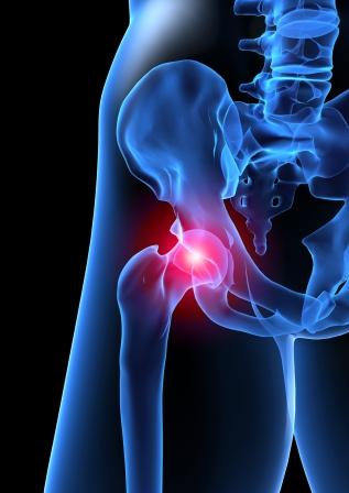 Hip Pain & Physiotherapy Hip Pain & Physiotherapy