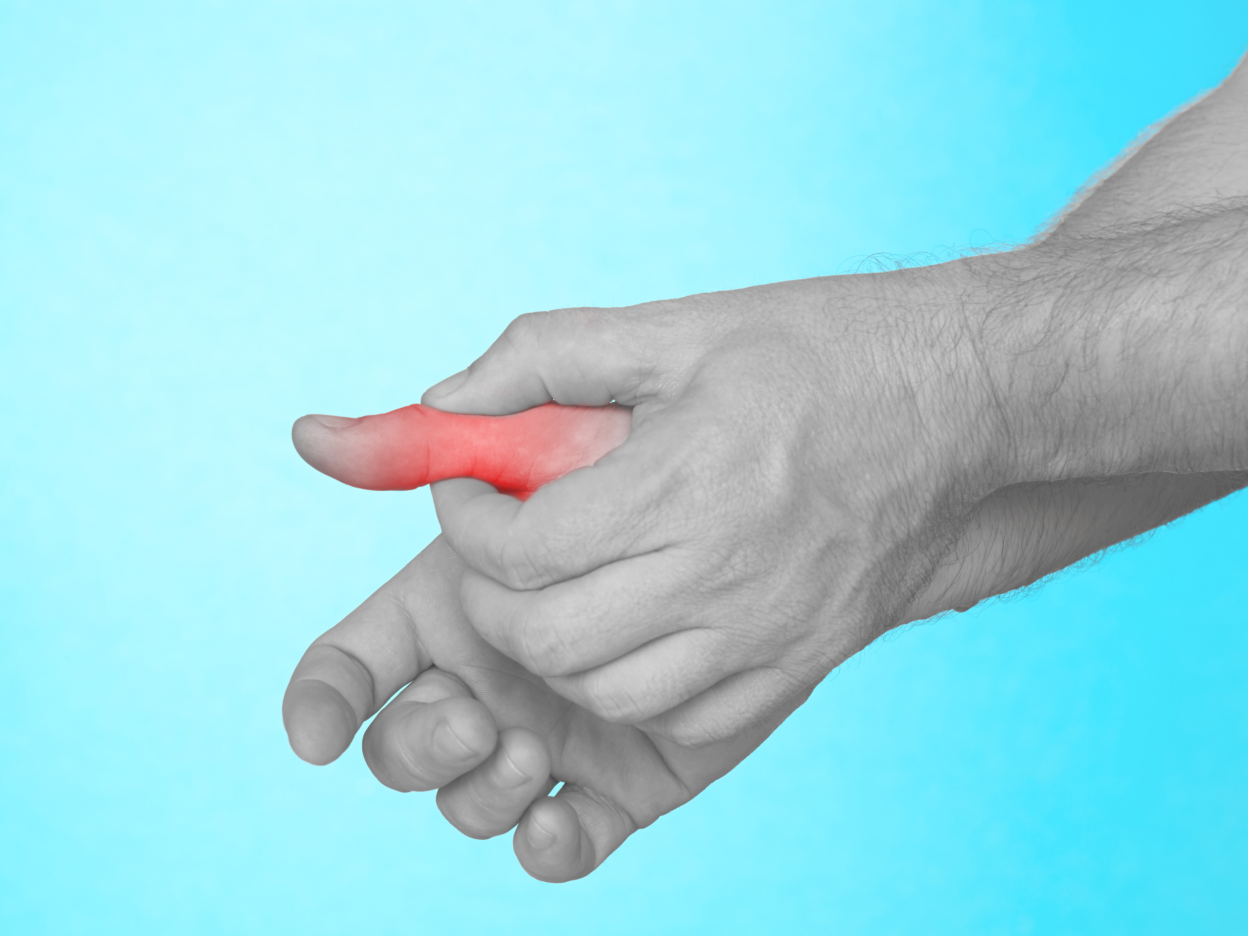 Thumb Sprain Physiotherapy Treatment Singapore. Fast pain relief