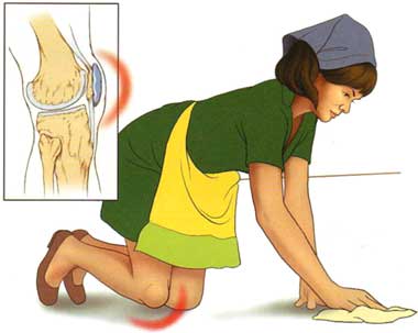 Prepatellar Bursitis - Physiotherapy Treatment Singapore. Fast pain relief.  Time for a fuller life.